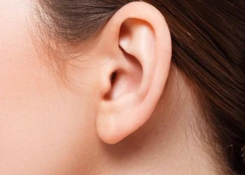 Cách trị sẹo lồi ở tai an toàn và hiệu quả