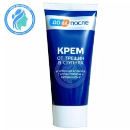 Kpem 50g - Kem trị nứt gót, dưỡng da mềm mịn